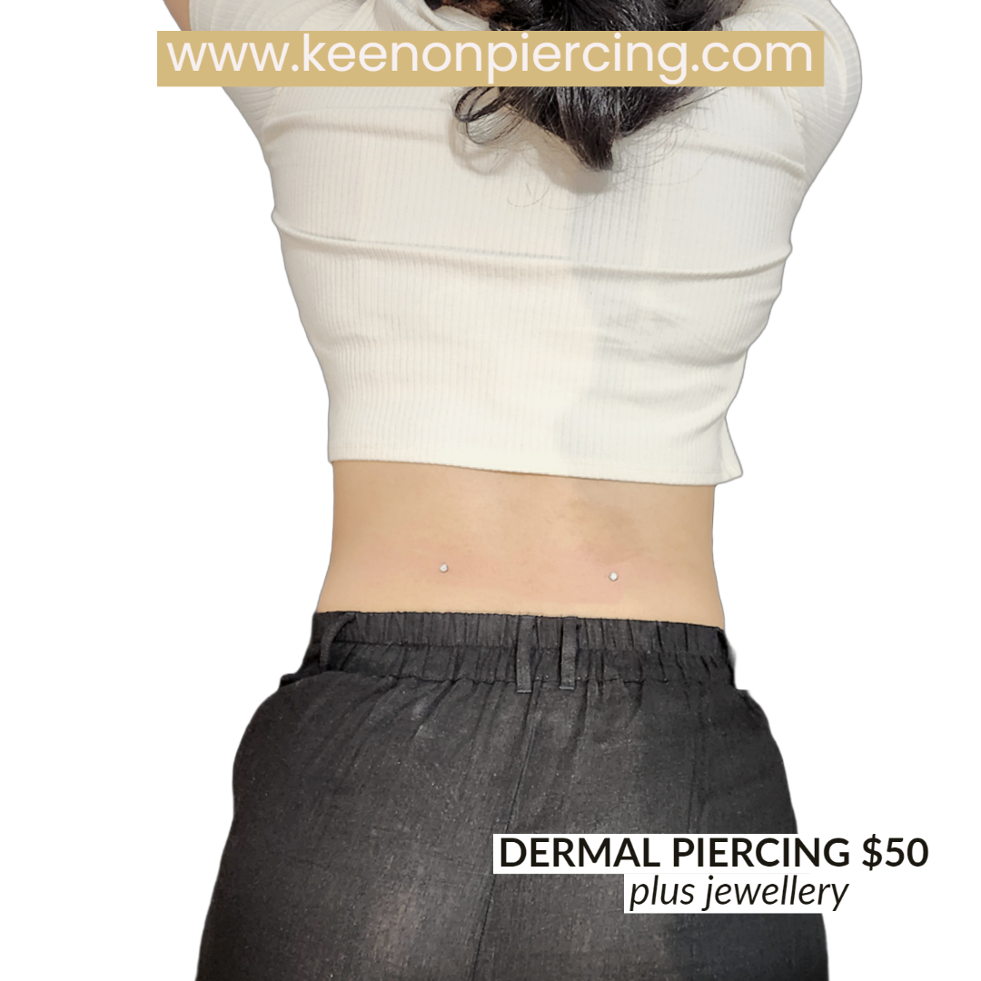 Dermal anchor sales online shop